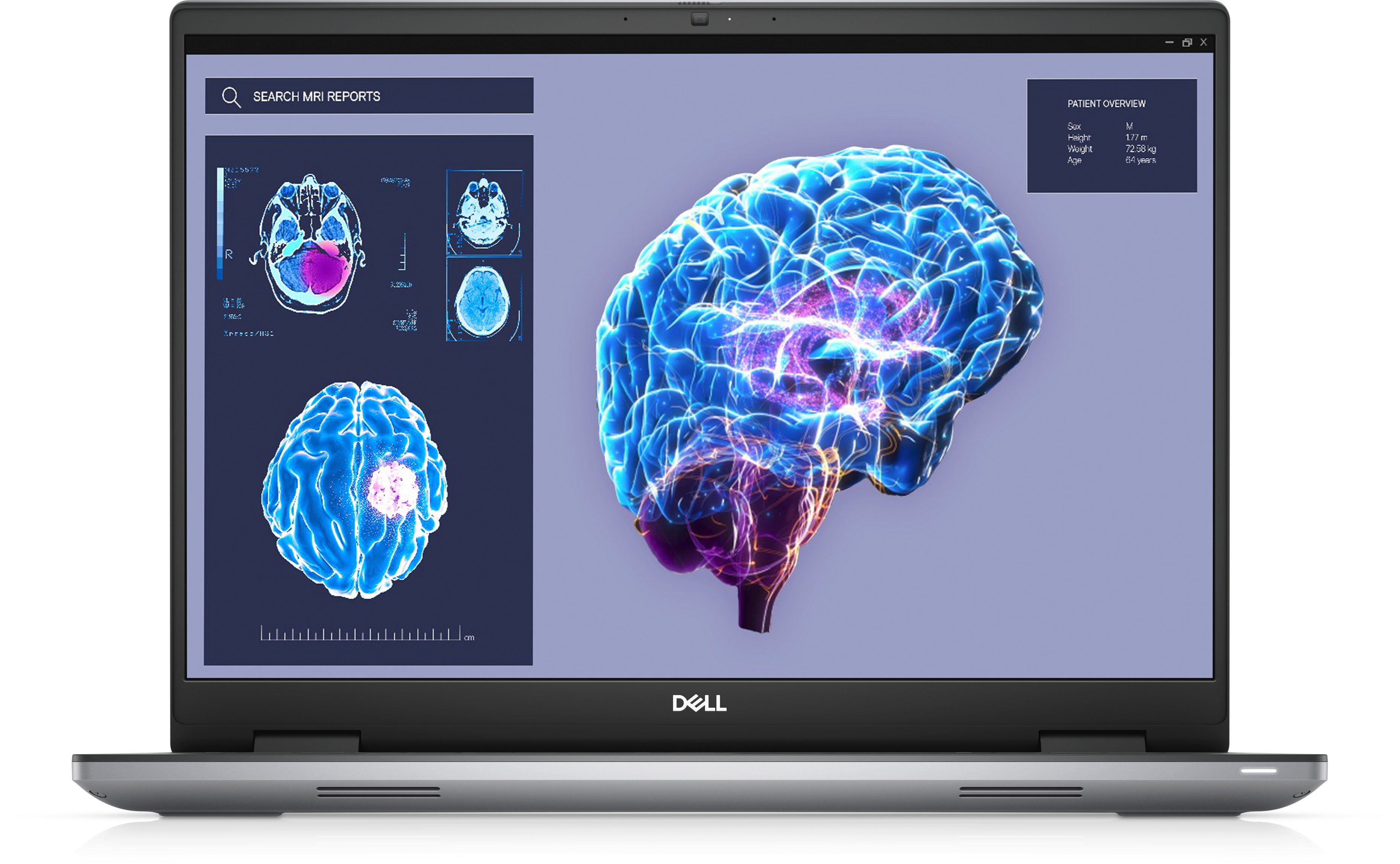 Dell Precision 7680 - Intel Core i7 - 13850HX / jusqu'à 5.3 GHz - Win 11 Pro - NVIDIA RTX 2000 Ada - 32 Go RAM - 1 To SSD NVMe, Class 40 - 16" 1920 x 1200 (Full HD Plus) - Gigabit Ethernet - Wi-Fi 6E - gris - clavier : Français - BTP - avec 3 ans de servi